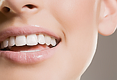 MAIN_BRACES_2f6a1969