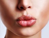 Kiss Your Lip Lines Good-Bye Kiss Your Lip Lines Good-Bye