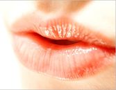 Ask An Expert: How To Prevent And Treat Lip Lines Ask An Expert: How To Prevent And Treat Lip Lines