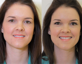 Eyelash Extensions: An Application Can Transform Your Look Eyelash Extensions: An Application Can Transform Your Look