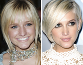 Chin Augmentation: The Key To A Perfect Jawline Chin Augmentation: The Key To A Perfect Jawline