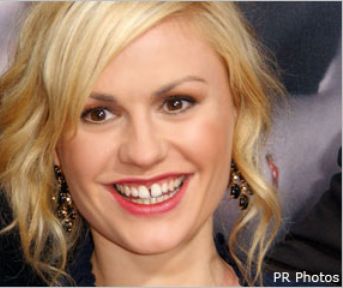 Gap-Toothed And Gorgeous: The Latest Beauty Trend Rebuffs Braces Gap-Toothed And Gorgeous: The Latest Beauty Trend Rebuffs Braces