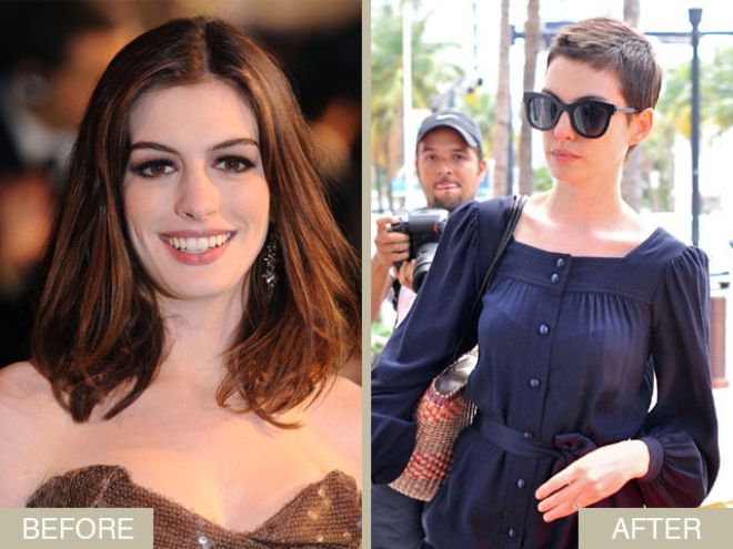 Poll: What’S The Most Drastic Thing You’Ve Done To Your Hair?