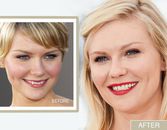 Kirsten Dunst's Smile Makeover: From Crooked To Confident Kirsten Dunst's Smile Makeover: From Crooked To Confident