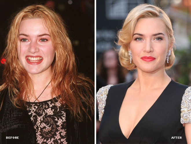 Kate Winslet's Shabby To Chic Makeover