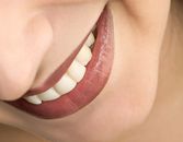 Makeover Your Smile in No Time Makeover Your Smile in No Time