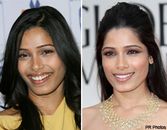 Your Smile: Less Gum, More Grin Your Smile: Less Gum, More Grin