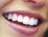 Why Your Yellow Teeth Are Aging You Why Your Yellow Teeth Are Aging You