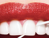 How to Fix Receding Gums How to Fix Receding Gums