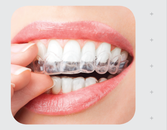 Keep Your Teeth Straight and Sexy After Braces Keep Your Teeth Straight and Sexy After Braces