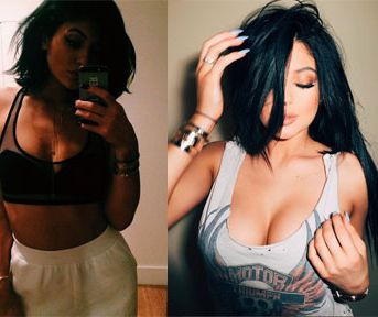 Rumor Has It: Did Kylie Jenner Get Breast Implants? Rumor Has It: Did Kylie Jenner Get Breast Implants?