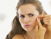 Zap That Zit: How to Treat Stress Breakouts Zap That Zit: How to Treat Stress Breakouts