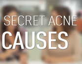 5 Sneaky Reasons You Get Acne 5 Sneaky Reasons You Get Acne
