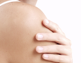 Weight Loss May Ease Psoriasis Weight Loss May Ease Psoriasis