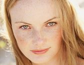 4 Types of Hyperpigmentation and What to do About it 4 Types of Hyperpigmentation and What to do About it