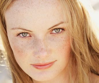 4 Types of Hyper Pigmentation and What to do About it 4 Types of Hyper Pigmentation and What to do About it
