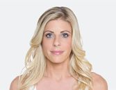 Liquid Lift: The 30 Minute Makeover? Liquid Lift: The 30 Minute Makeover?