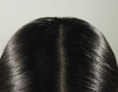 Coming Soon: A Way to Prevent Hair Loss During Chemo Coming Soon: A Way to Prevent Hair Loss During Chemo