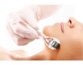 The Truth About Microneedling The Truth About Microneedling