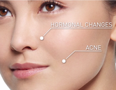 How To Prevent Dark Spots How To Prevent Dark Spots