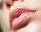 Fuller Lips With Help From Your Dentist Fuller Lips With Help From Your Dentist