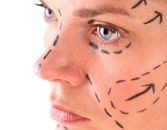 How Short-Scar Facelifts Give Their Lift How Short-Scar Facelifts Give Their Lift