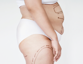 Solutions for a Slimmer Stomach Solutions for a Slimmer Stomach