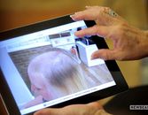 Hair Loss Solutions That Really Work Hair Loss Solutions That Really Work