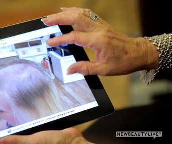 Hair Loss Solutions That Really Work Hair Loss Solutions That Really Work